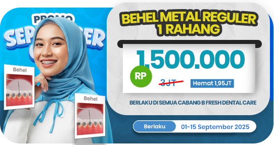 Behel Metal Reguler 1 rahang